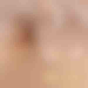 Невидлив градник со подигнување | SILKYLIFT